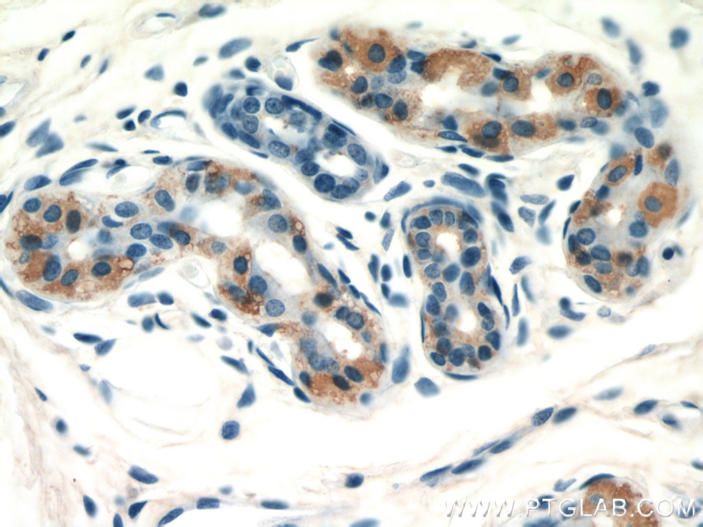 Immunohistochemistry (IHC) staining of human skin tissue using GDI2 Polyclonal antibody (55096-1-AP)