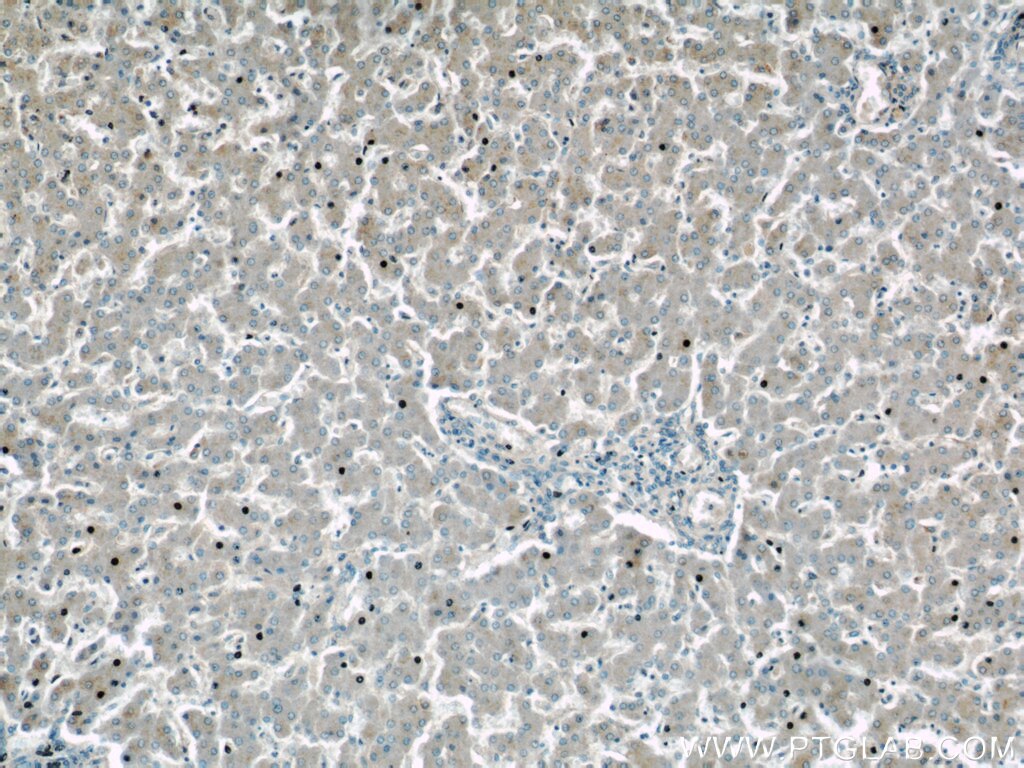 Immunohistochemistry (IHC) staining of human liver tissue using GDI2 Polyclonal antibody (55096-1-AP)