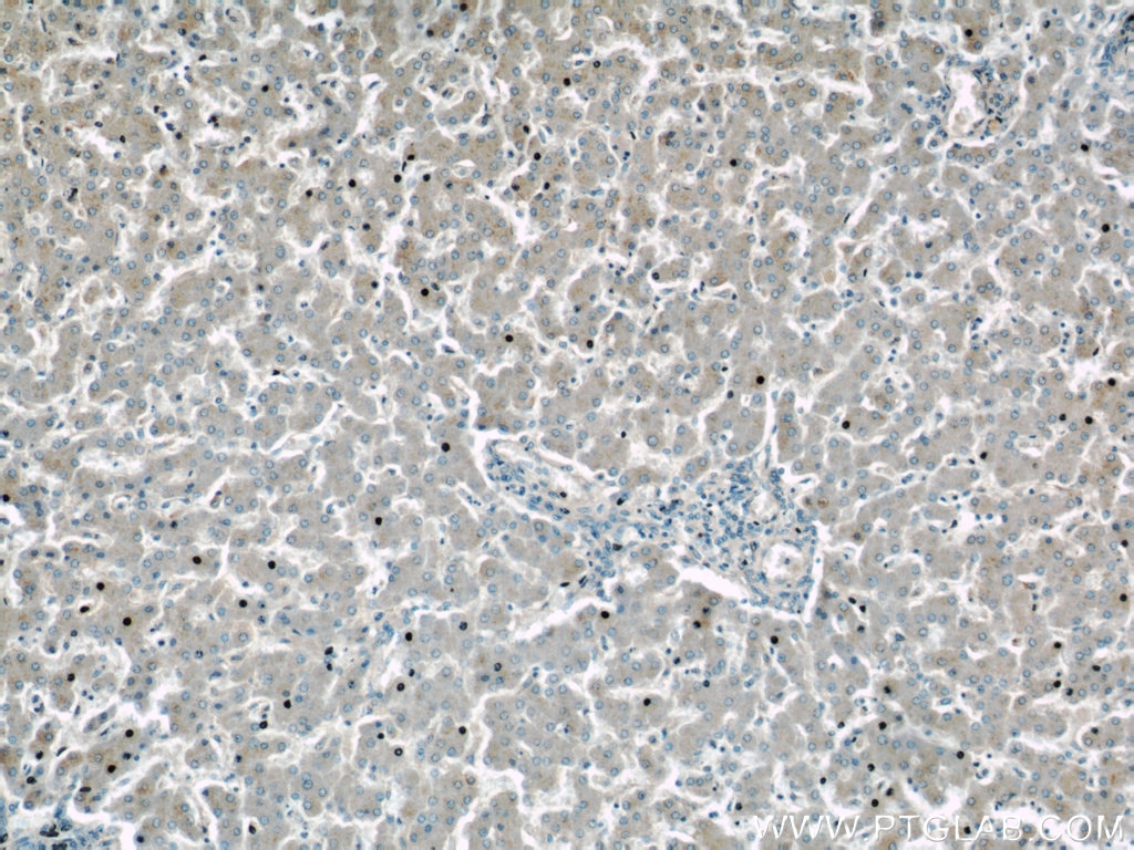 Immunohistochemistry (IHC) staining of human liver tissue using GDI2 Polyclonal antibody (55096-1-AP)