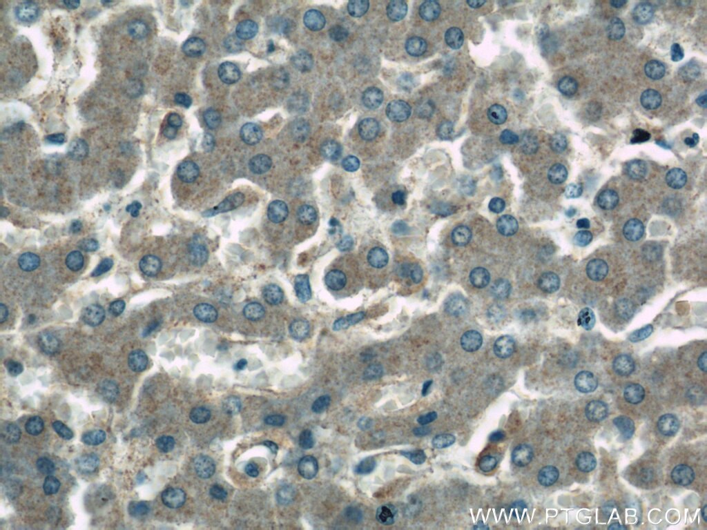 Immunohistochemistry (IHC) staining of human liver tissue using GDI2 Polyclonal antibody (55096-1-AP)