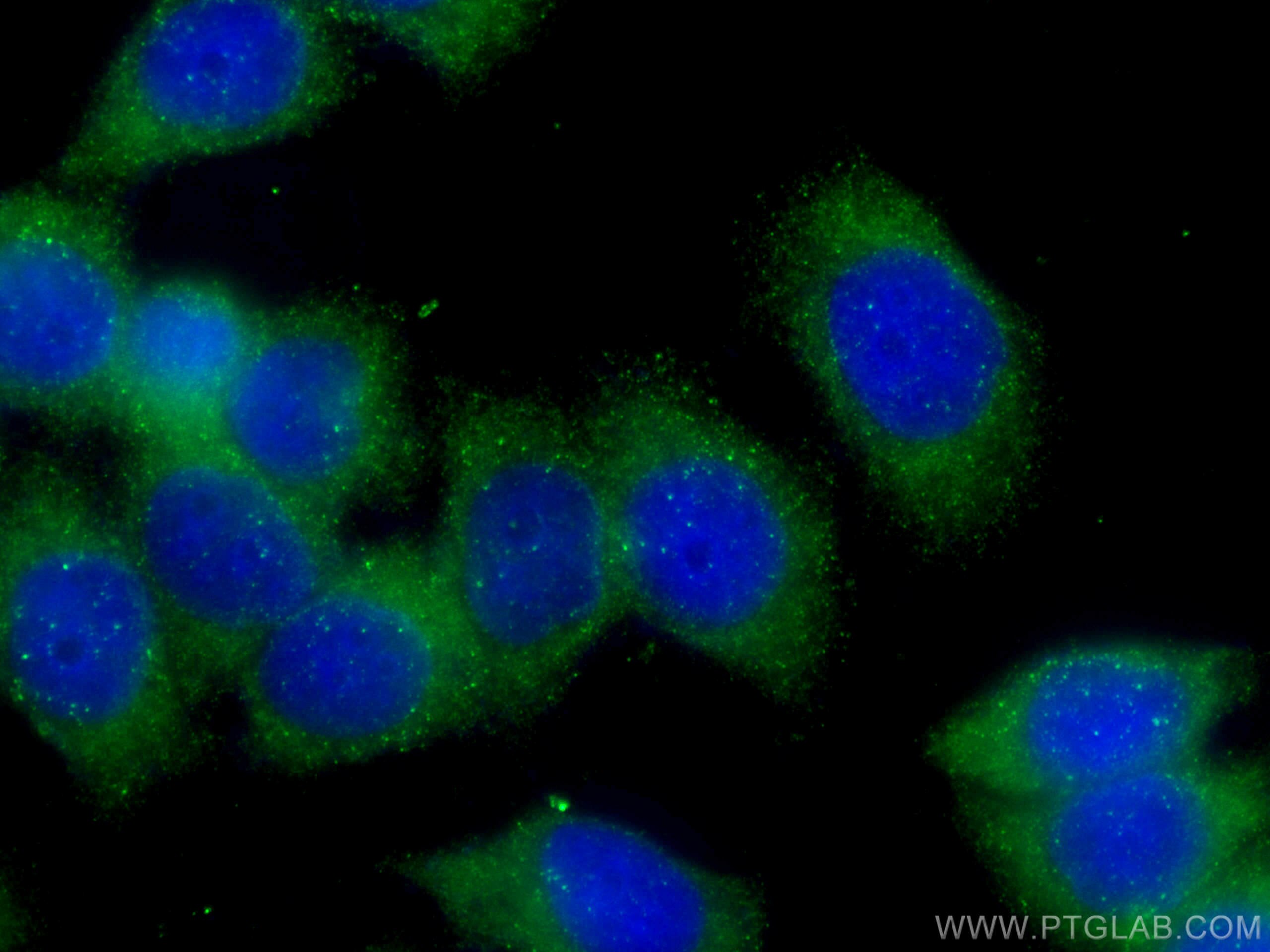 Immunofluorescence (IF) / fluorescent staining of HeLa cells using GDI2 Monoclonal antibody (60078-1-Ig)