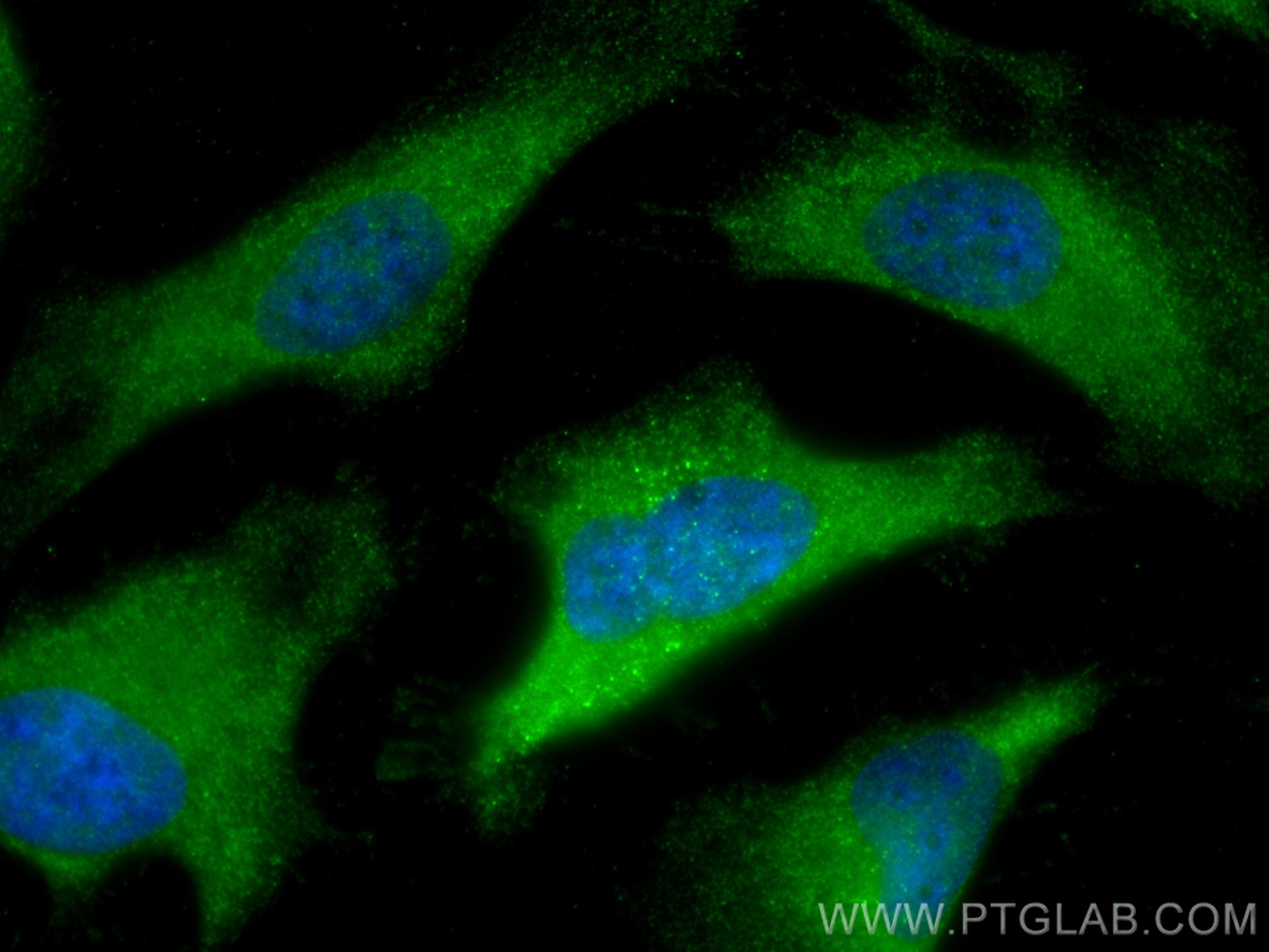Immunofluorescence (IF) / fluorescent staining of HeLa cells using GDI2 Monoclonal antibody (60078-1-Ig)