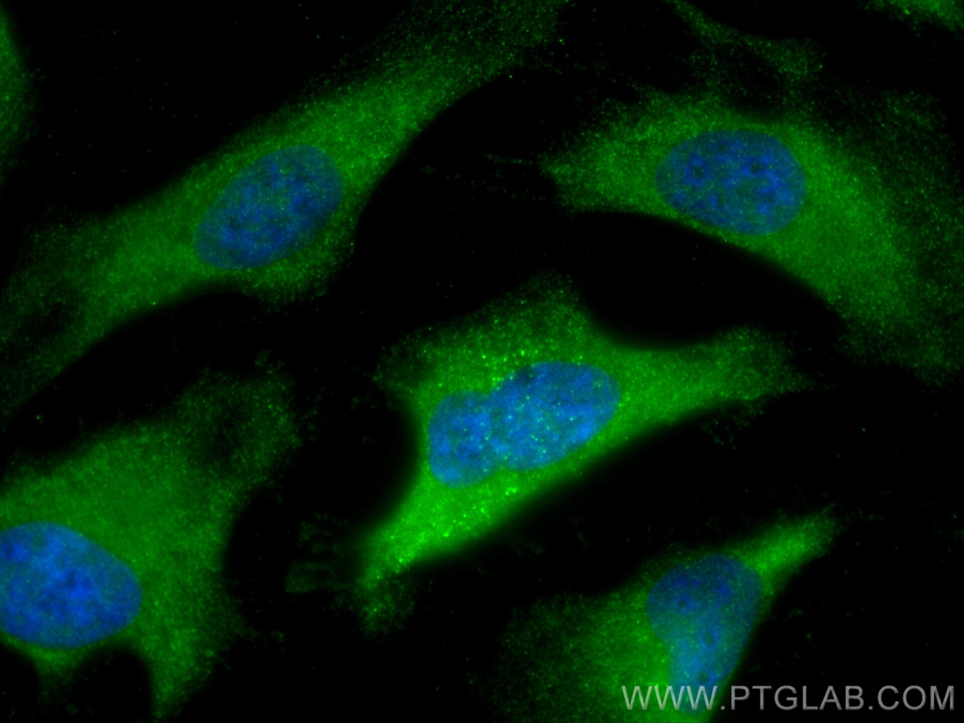 IF Staining of HeLa using 60078-1-Ig