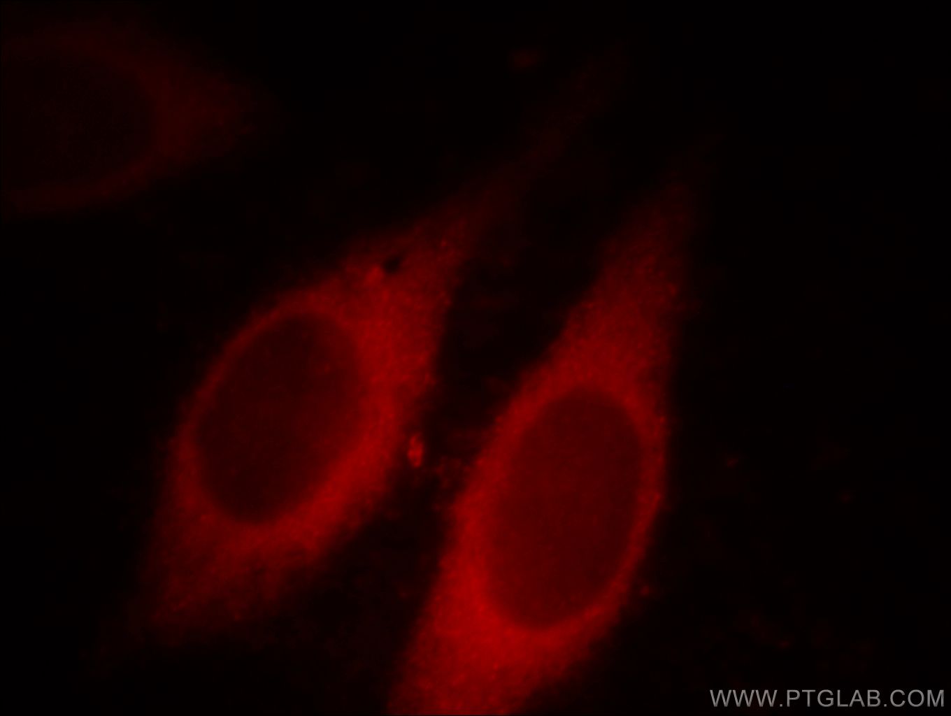 Immunofluorescence (IF) / fluorescent staining of HeLa cells using GDI2 Monoclonal antibody (60078-1-Ig)