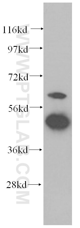 Western Blot (WB) analysis of HepG2 cells using GDI2 Monoclonal antibody (60078-1-Ig)