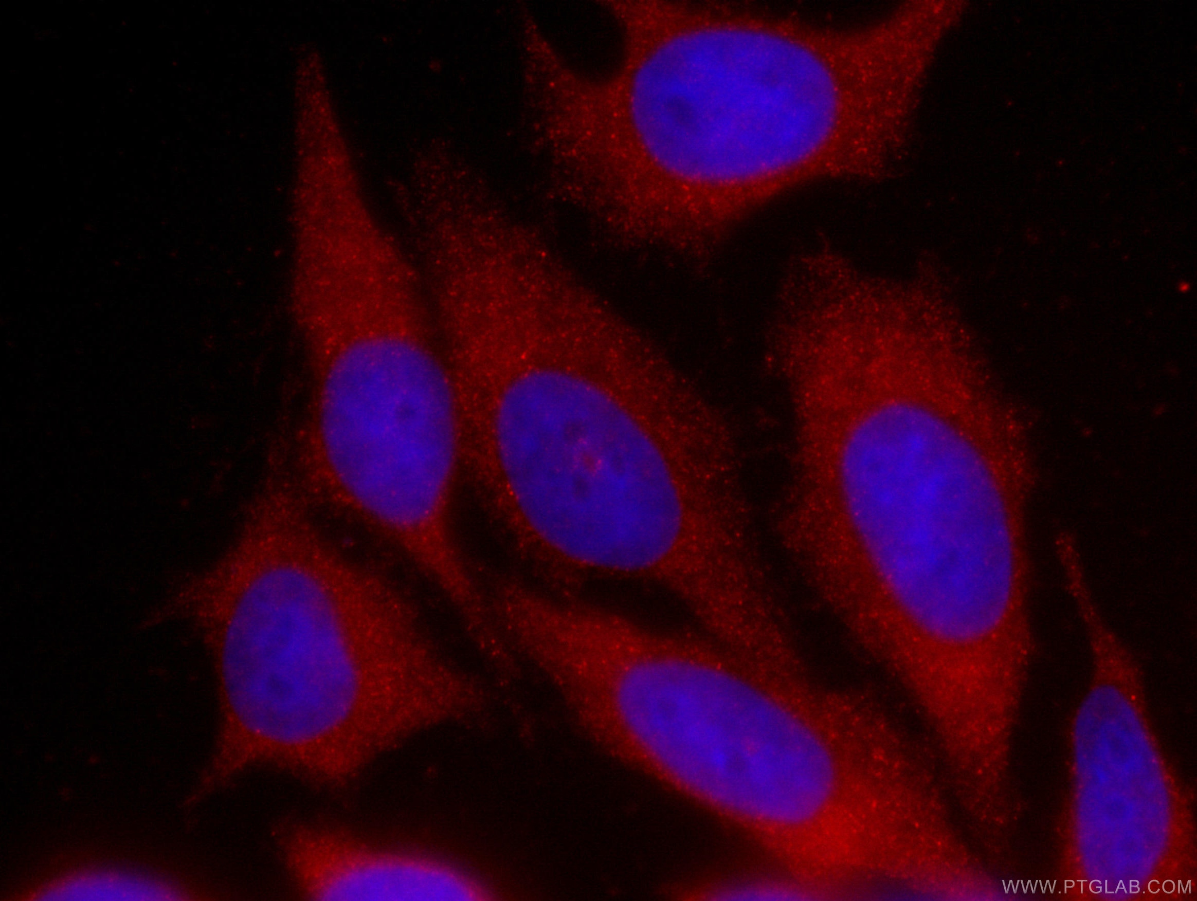 IF Staining of HeLa using CL594-60078