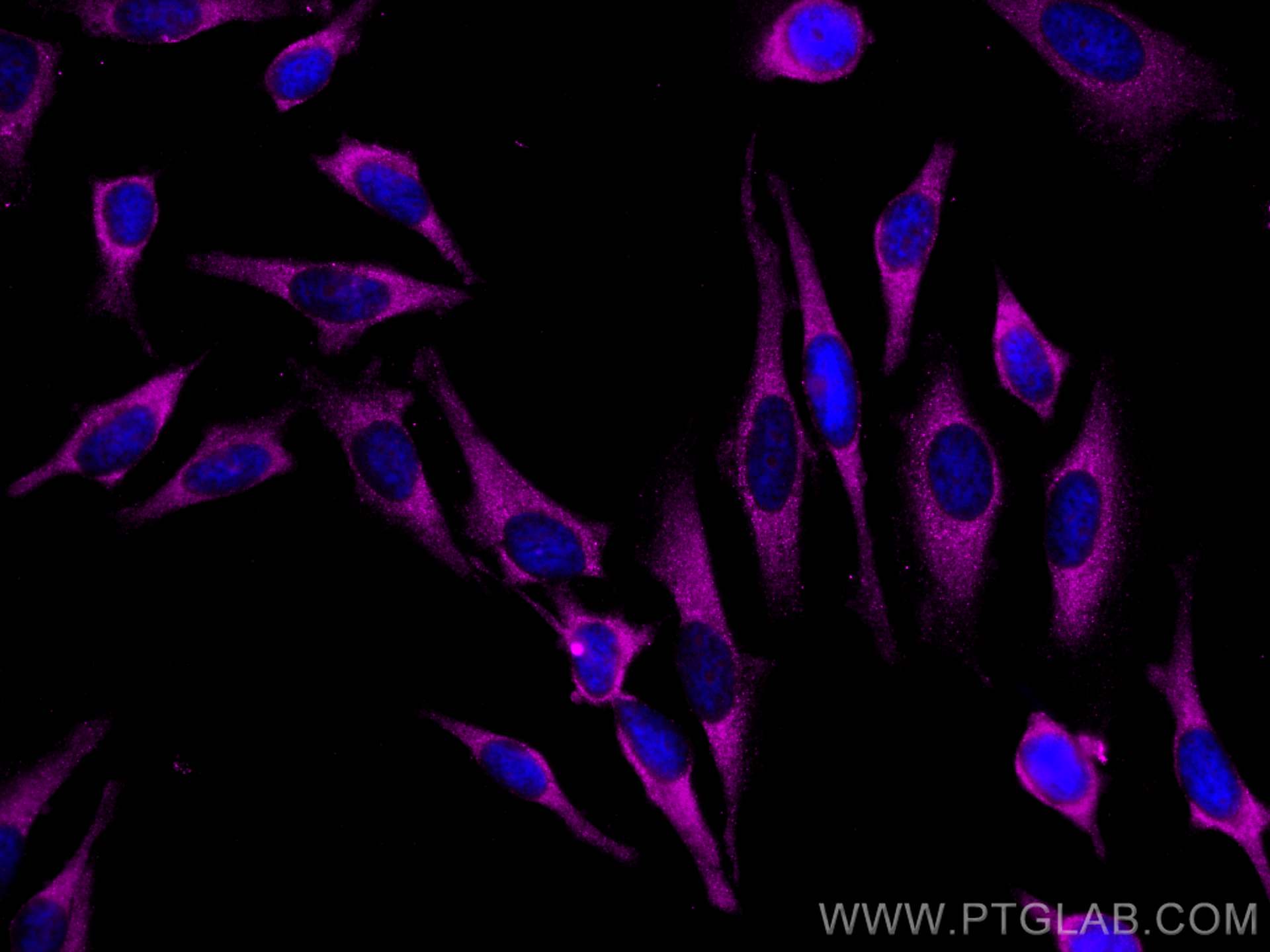 Immunofluorescence (IF) / fluorescent staining of HeLa cells using CoraLite® Plus 647-conjugated GDI2 Monoclonal anti (CL647-60078)