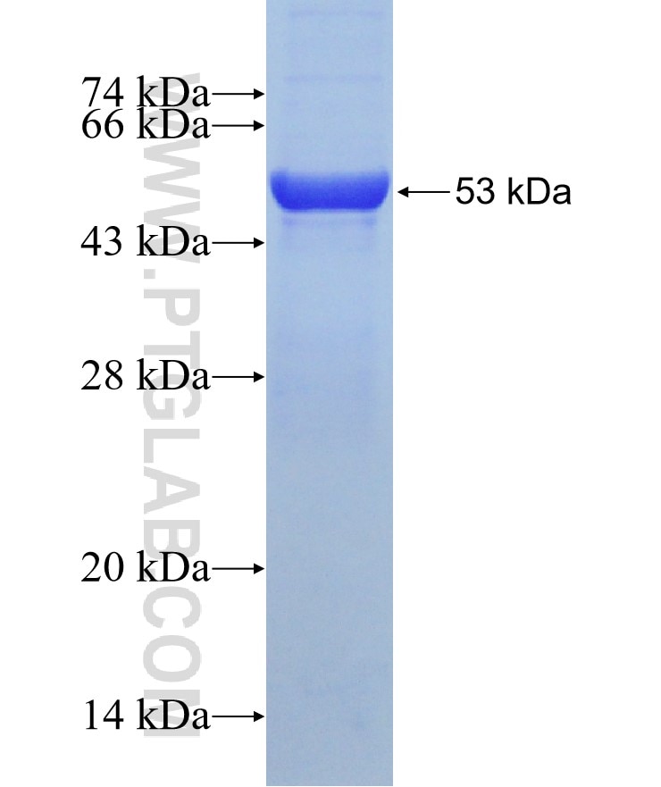 GDI2 fusion protein Ag0170 SDS-PAGE