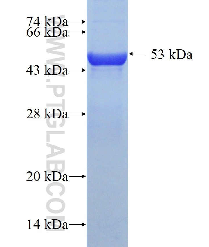 GDI2 fusion protein Ag0170 SDS-PAGE