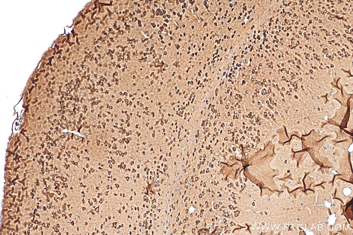 Immunohistochemistry (IHC) staining of mouse brain tissue using GDNF Polyclonal antibody (26179-1-AP)