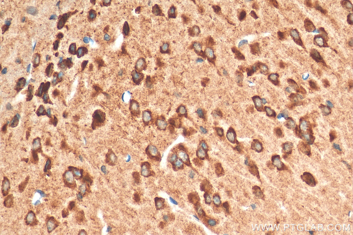 Immunohistochemistry (IHC) staining of mouse brain tissue using GDNF Polyclonal antibody (26179-1-AP)
