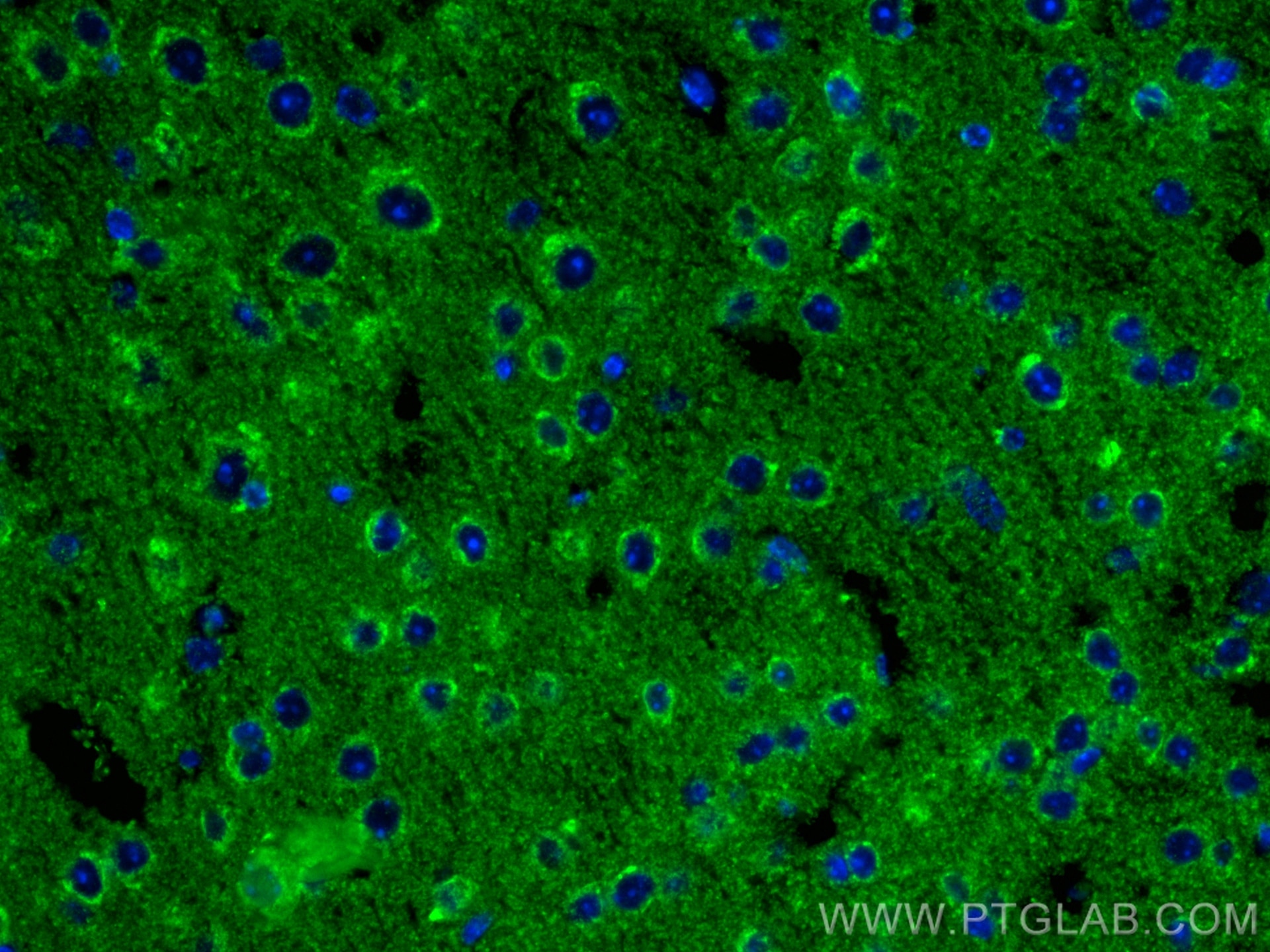 Immunofluorescence (IF) / fluorescent staining of mouse brain tissue using GDNF Recombinant antibody (83087-1-RR)