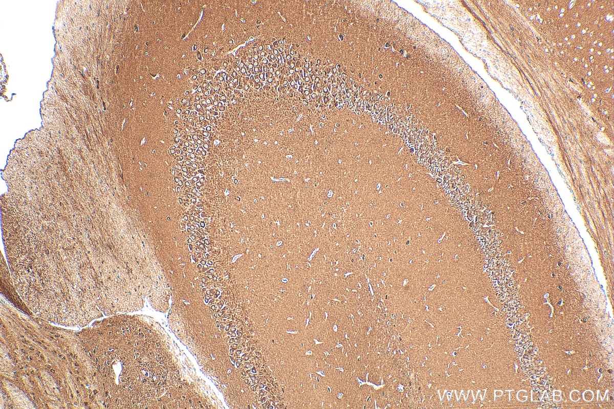 Immunohistochemistry (IHC) staining of mouse brain tissue using GDNF Recombinant antibody (83087-1-RR)