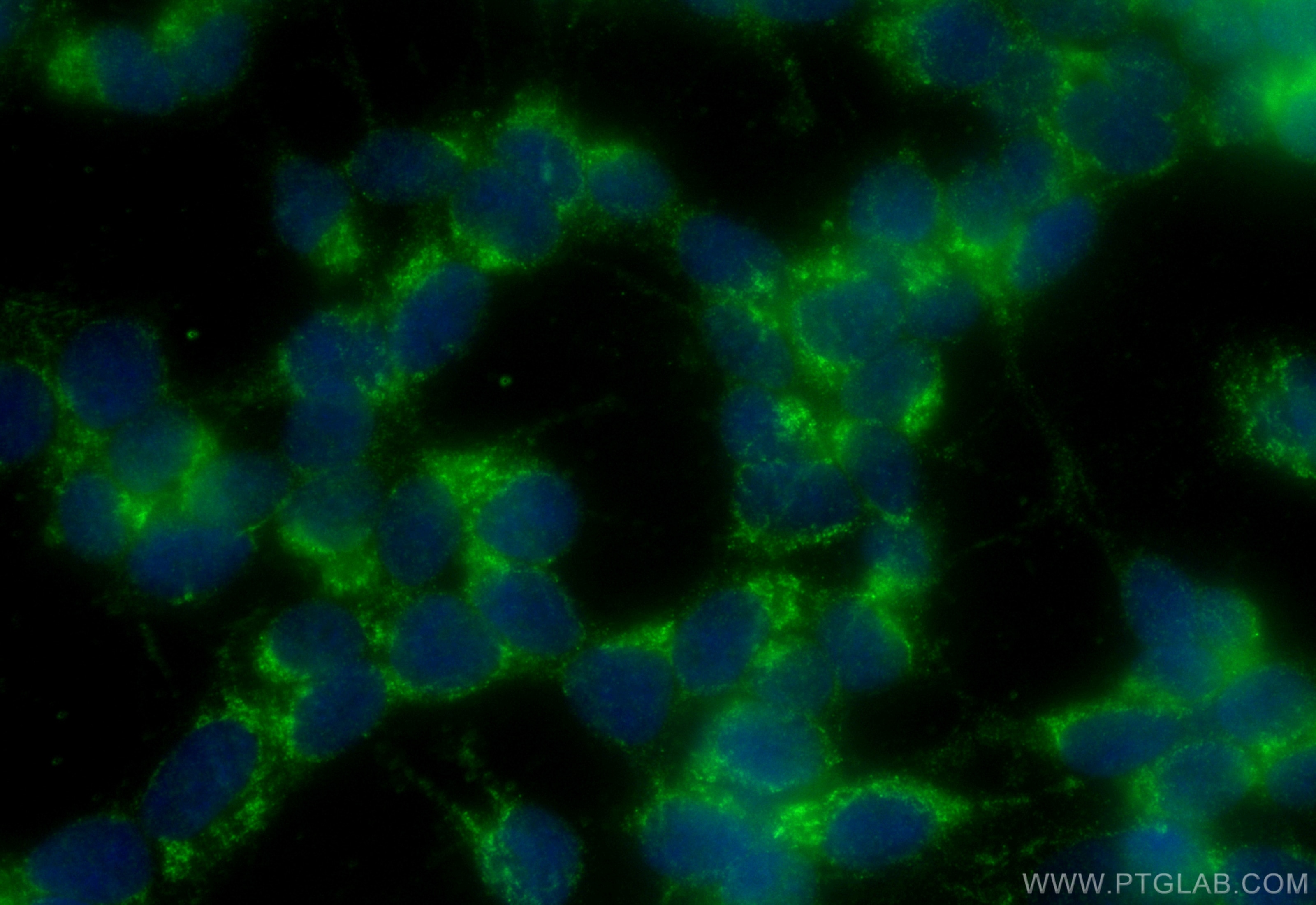 Immunofluorescence (IF) / fluorescent staining of SH-SY5Y cells using CoraLite® Plus 488-conjugated GDNF Recombinant ant (CL488-83087)