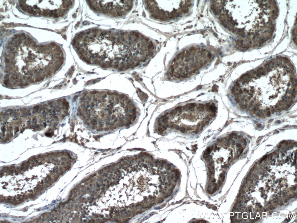 Immunohistochemistry (IHC) staining of human testis tissue using GDPD1 Polyclonal antibody (27861-1-AP)