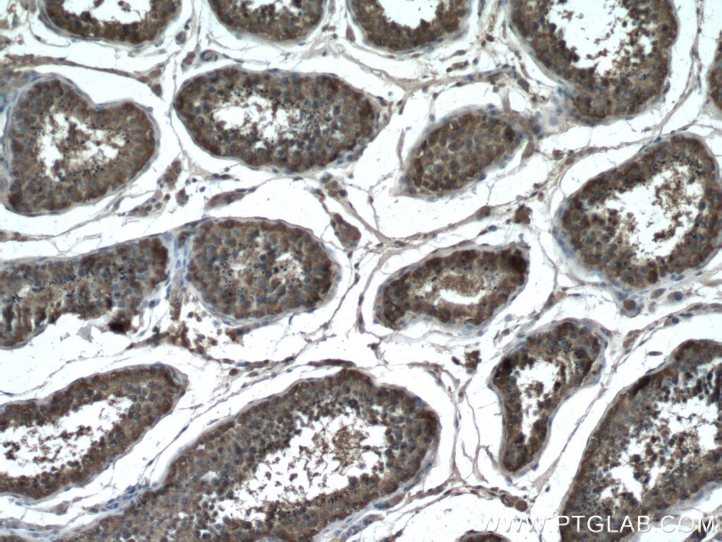 IHC staining of human testis using 27861-1-AP