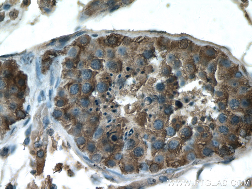 Immunohistochemistry (IHC) staining of human testis tissue using GDPD1 Polyclonal antibody (27861-1-AP)