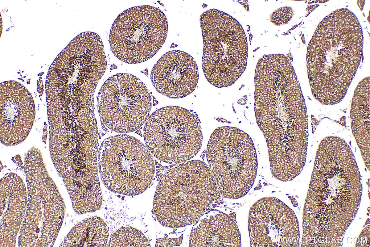 Immunohistochemistry (IHC) staining of mouse testis tissue using GDPD1 Polyclonal antibody (27861-1-AP)