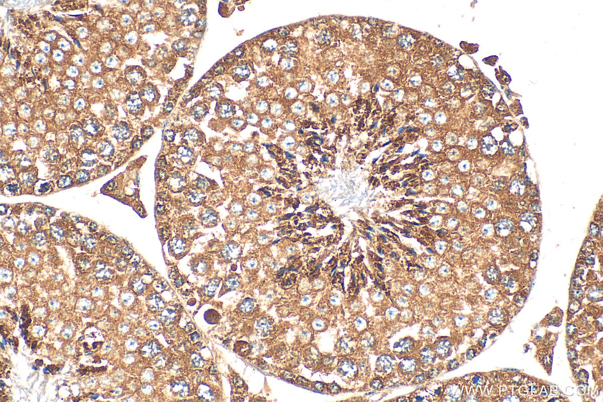 Immunohistochemistry (IHC) staining of mouse testis tissue using GDPD1 Polyclonal antibody (27861-1-AP)