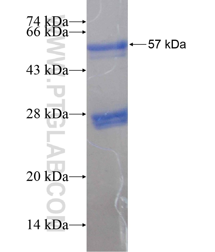 GDPD2 fusion protein Ag18377 SDS-PAGE