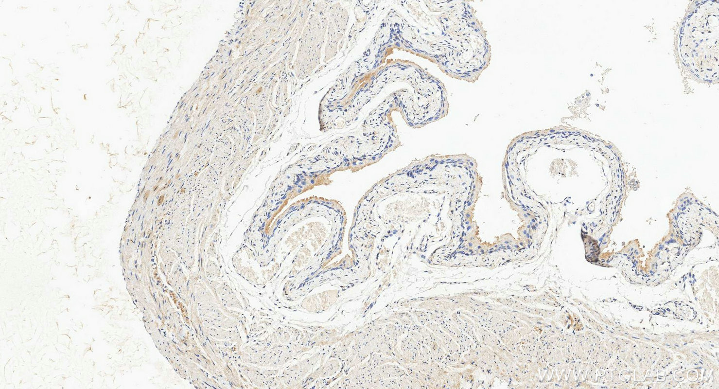 IHC staining of mouse bladder using 20390-1-AP Immunohistochemistry (IHC) staining of mouse bladder tissue using GDPD3 Polyclonal antibody (20390-1-AP)