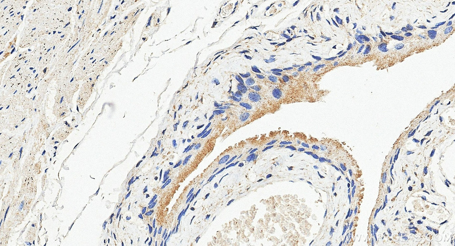 IHC staining of mouse bladder using 20390-1-AP Immunohistochemistry (IHC) staining of mouse bladder tissue using GDPD3 Polyclonal antibody (20390-1-AP)