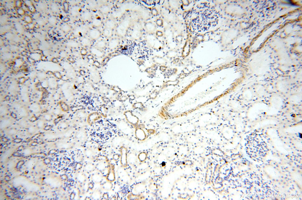 Immunohistochemistry (IHC) staining of human kidney tissue using GDPD5 Polyclonal antibody (16494-1-AP)