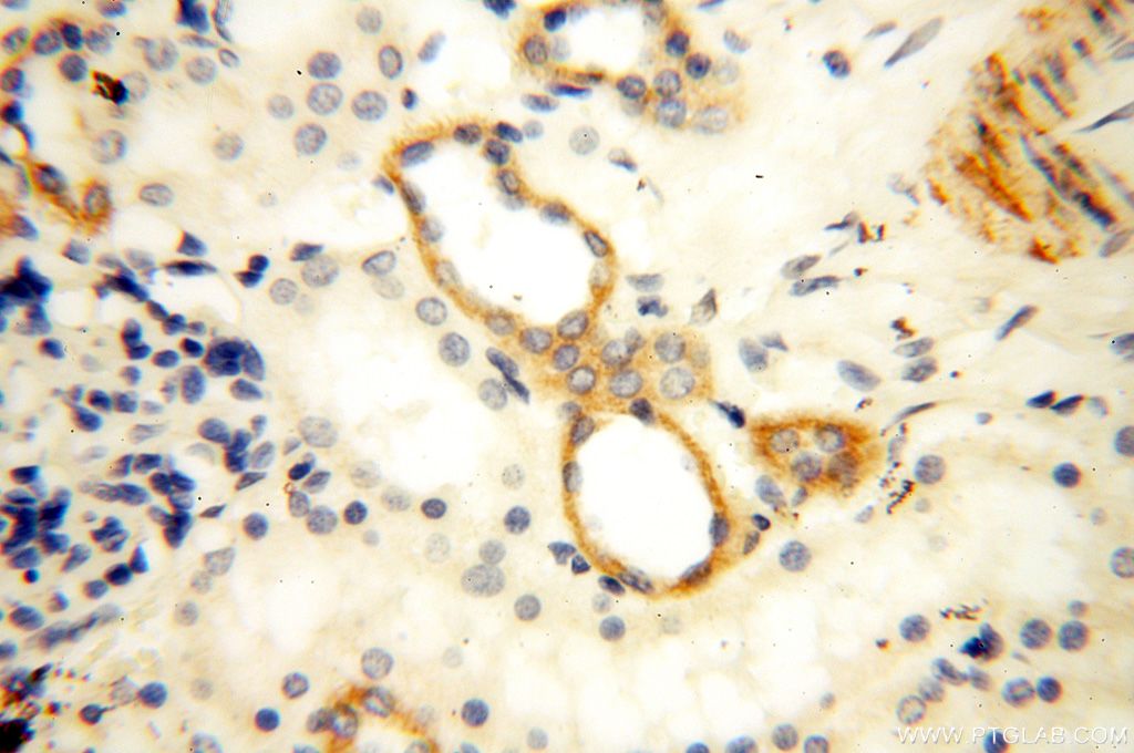 Immunohistochemistry (IHC) staining of human kidney tissue using GDPD5 Polyclonal antibody (16494-1-AP)
