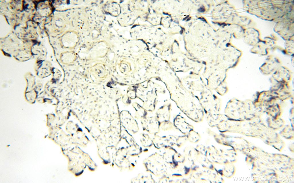 Immunohistochemistry (IHC) staining of human placenta tissue using GDPD5 Polyclonal antibody (16494-1-AP)