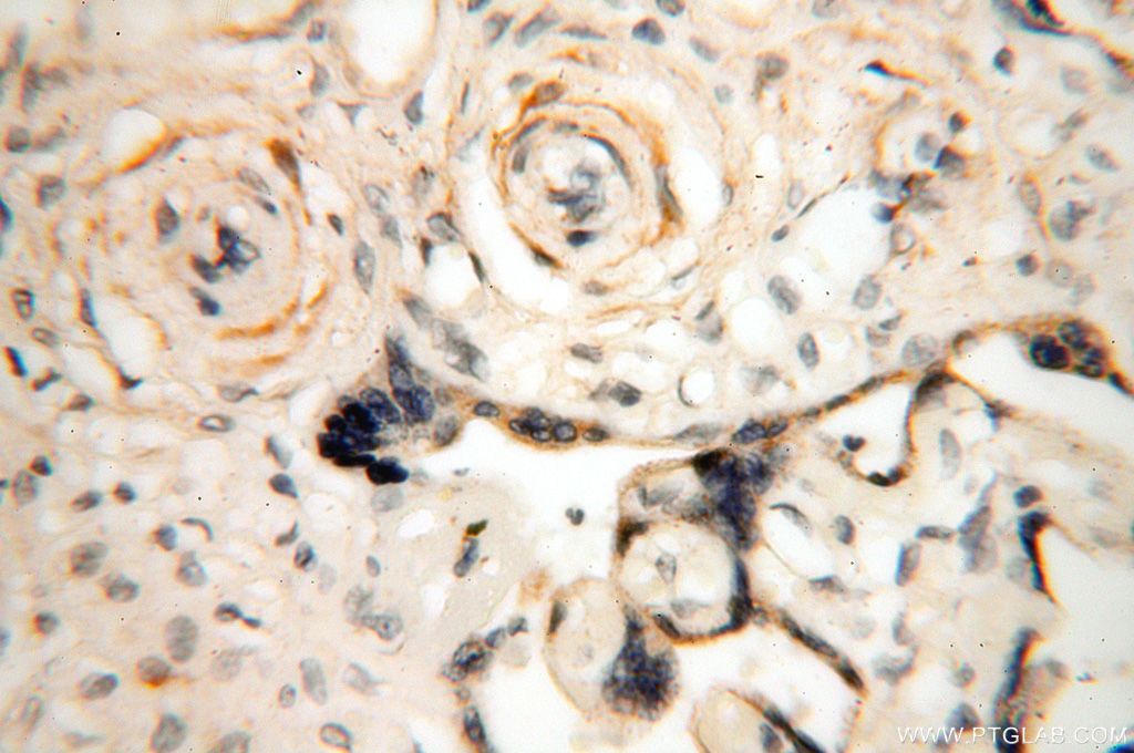 Immunohistochemistry (IHC) staining of human placenta tissue using GDPD5 Polyclonal antibody (16494-1-AP)