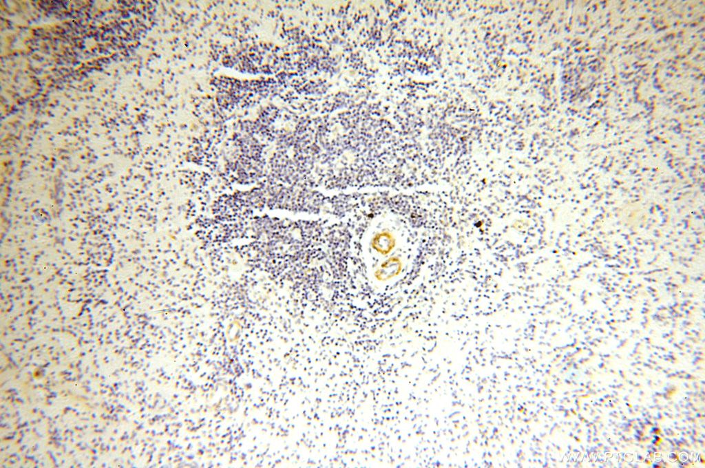 Immunohistochemistry (IHC) staining of human spleen tissue using GDPD5 Polyclonal antibody (16494-1-AP)