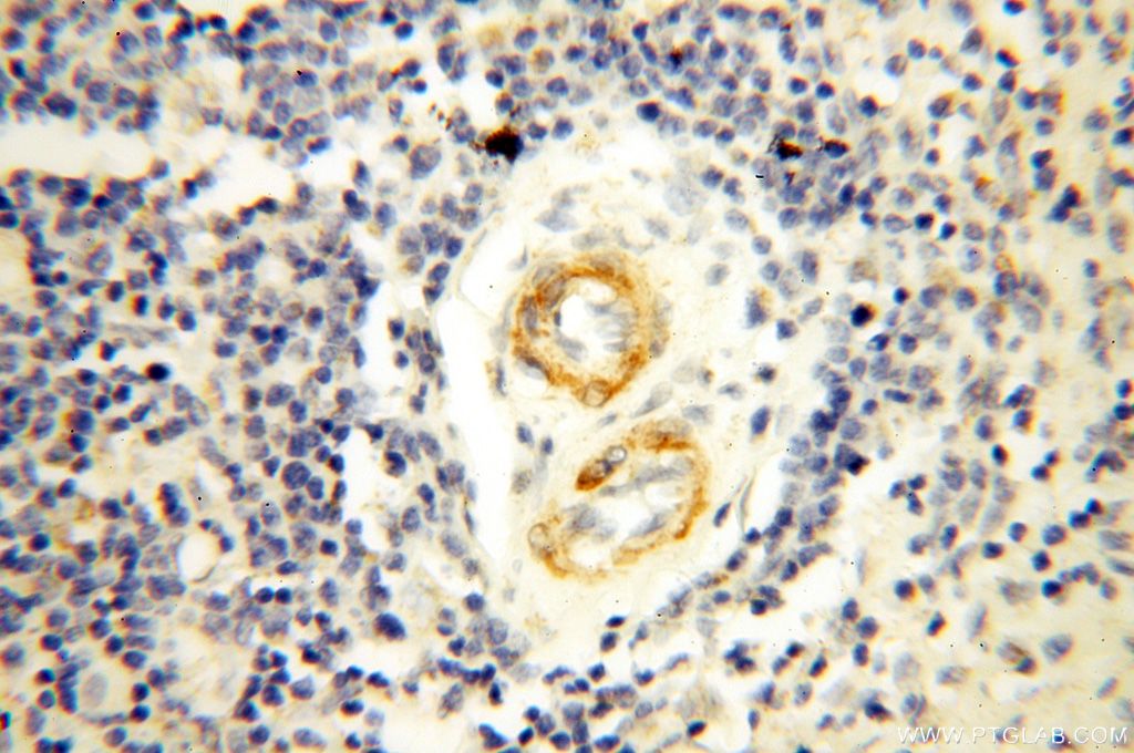 Immunohistochemistry (IHC) staining of human spleen tissue using GDPD5 Polyclonal antibody (16494-1-AP)