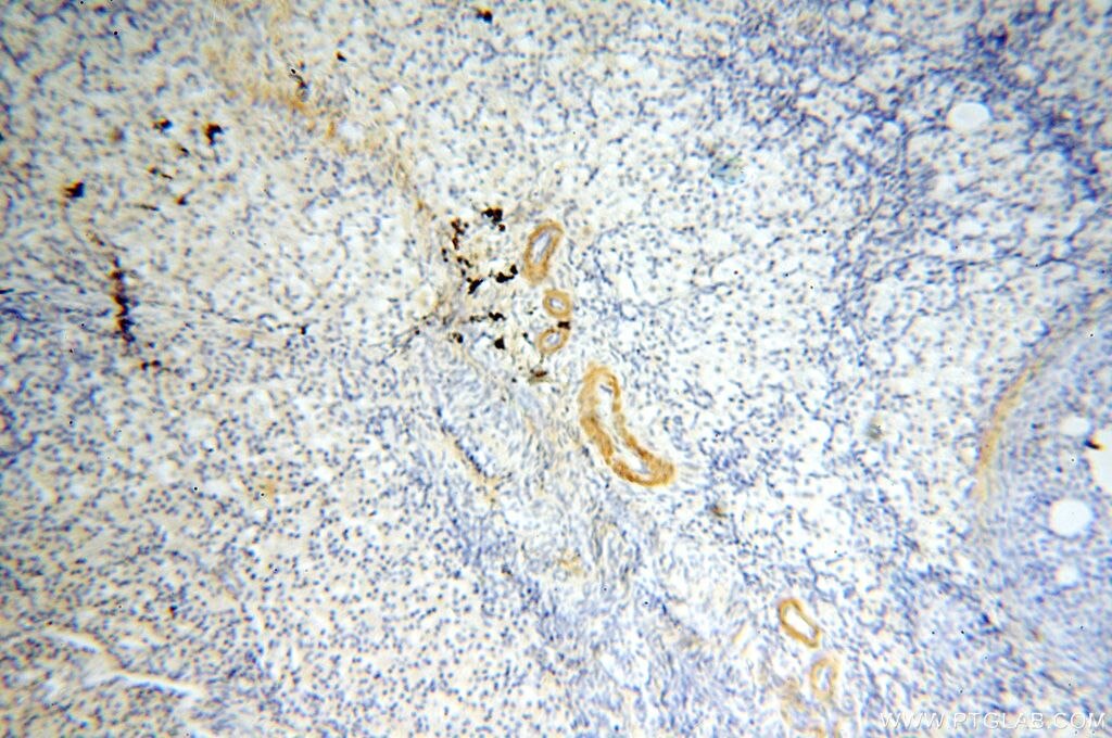 Immunohistochemistry (IHC) staining of human ovary tissue using GDPD5 Polyclonal antibody (16494-1-AP)