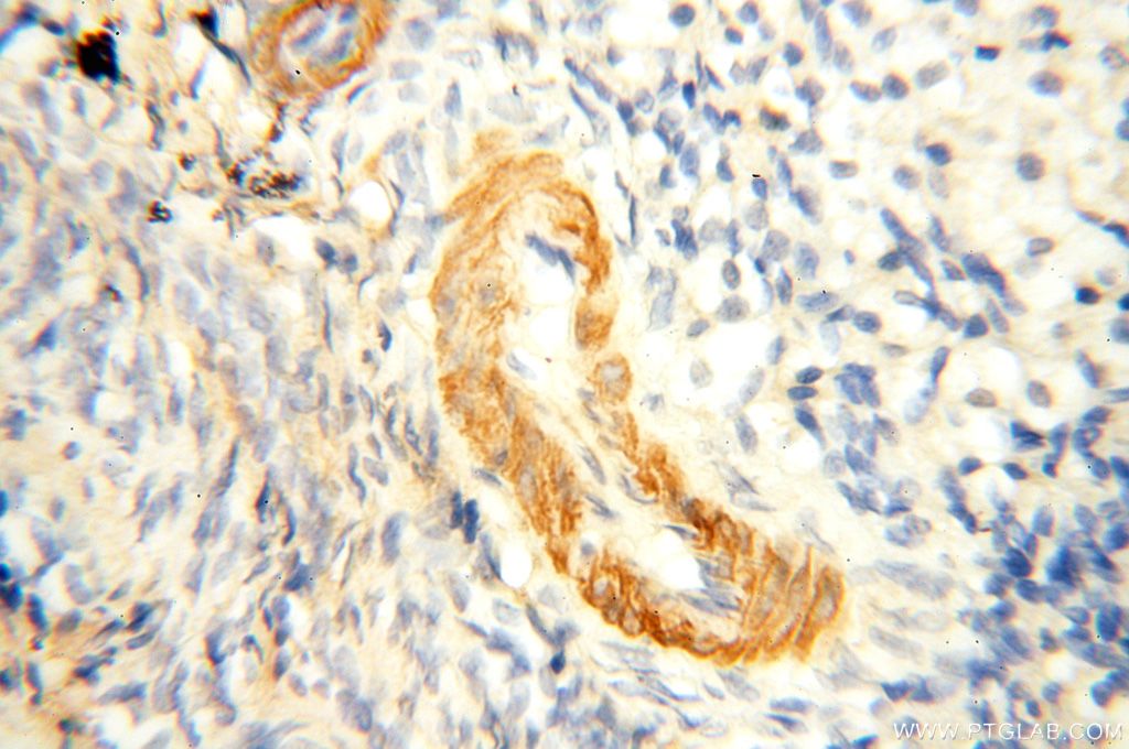 Immunohistochemistry (IHC) staining of human ovary tissue using GDPD5 Polyclonal antibody (16494-1-AP)