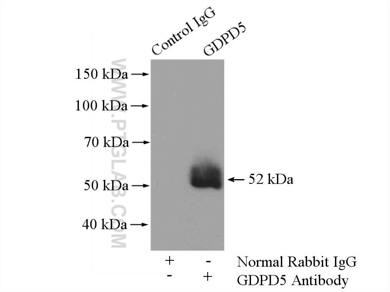 Immunoprecipitation (IP) experiment of mouse skeletal muscle tissue using GDPD5 Polyclonal antibody (16494-1-AP)