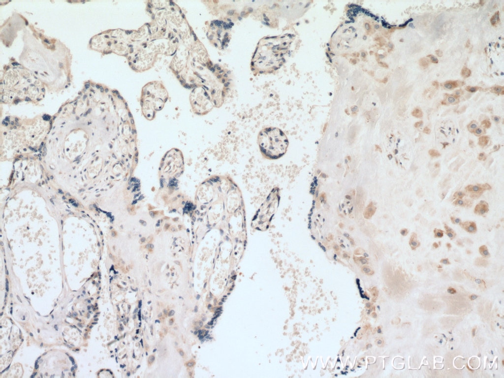 Immunohistochemistry (IHC) staining of human placenta tissue using GDPD5 Polyclonal antibody (25703-1-AP)