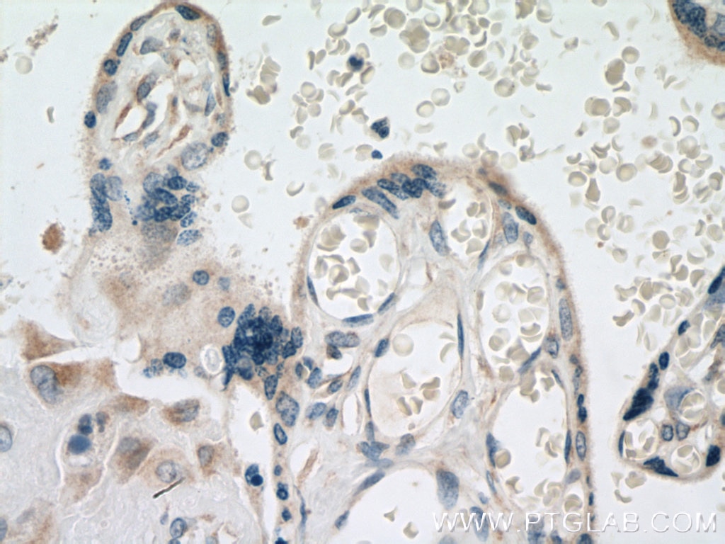 Immunohistochemistry (IHC) staining of human placenta tissue using GDPD5 Polyclonal antibody (25703-1-AP)