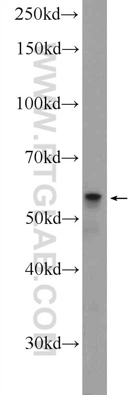 Western Blot (WB) analysis of K-562 cells using GDPD5 Polyclonal antibody (25703-1-AP)