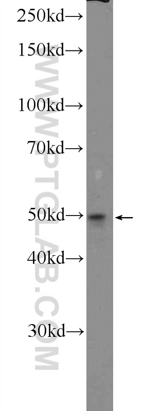 Western Blot (WB) analysis of COLO 320 cells using GDPD5 Polyclonal antibody (25703-1-AP)