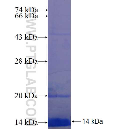 GDPD5 fusion protein Ag22530 SDS-PAGE
