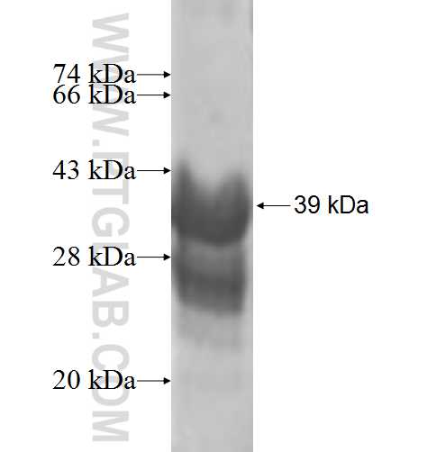 GDPD5 fusion protein Ag9622 SDS-PAGE