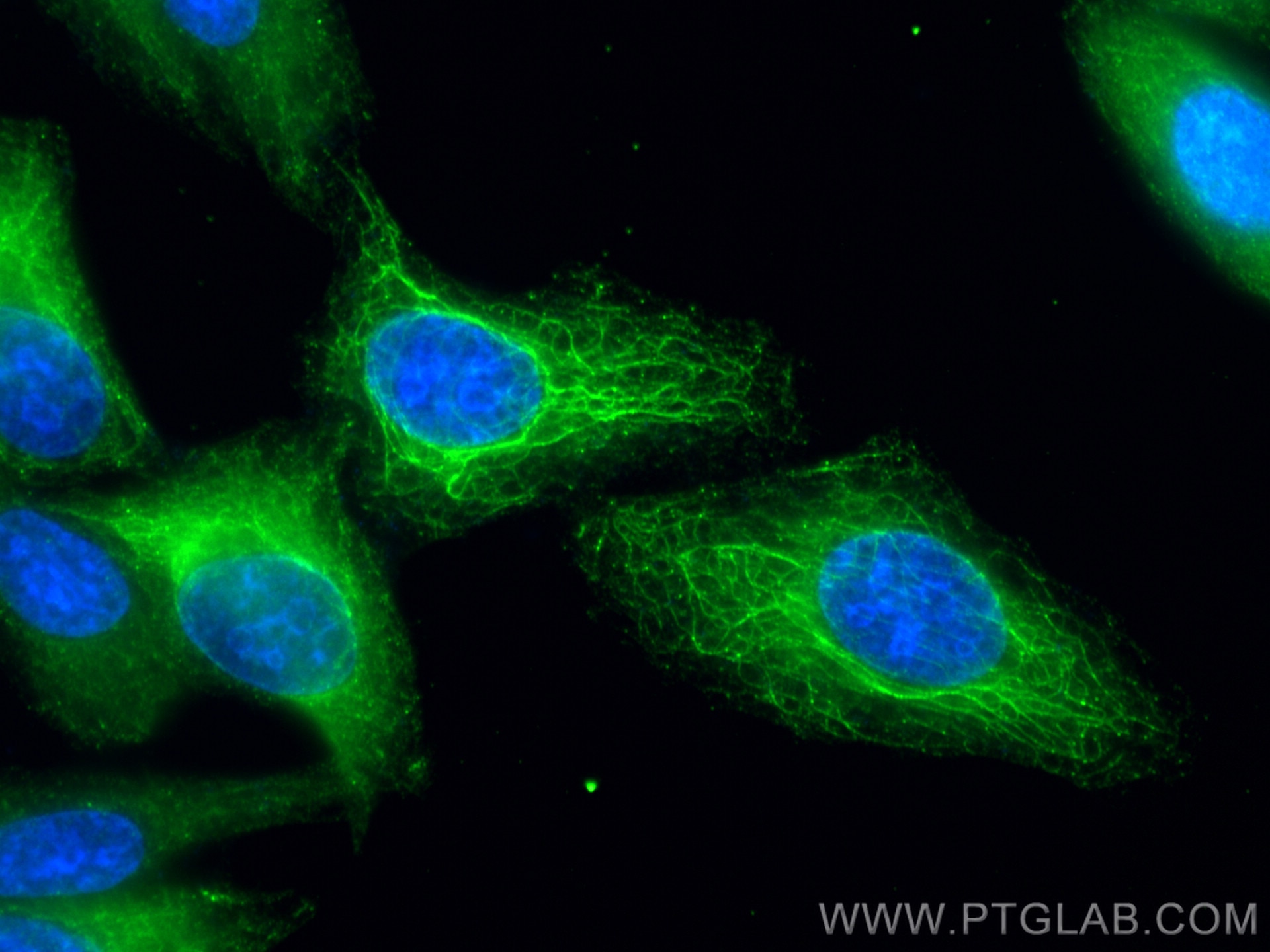 Immunofluorescence (IF) / fluorescent staining of HepG2 cells using GEF-H1 Polyclonal antibody (24472-1-AP)