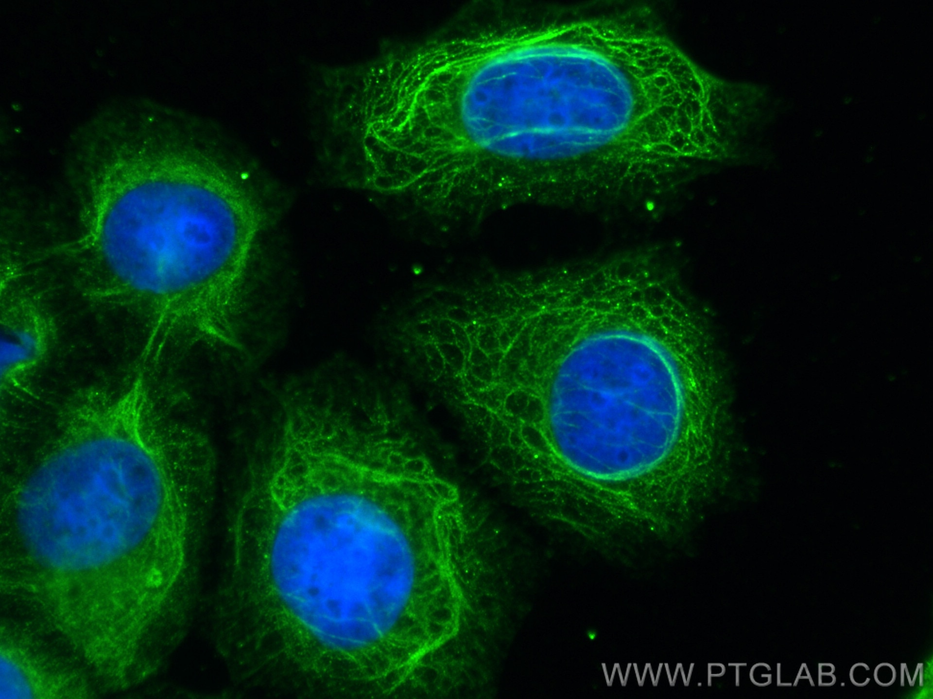 Immunofluorescence (IF) / fluorescent staining of MCF-7 cells using GEF-H1 Polyclonal antibody (24472-1-AP)