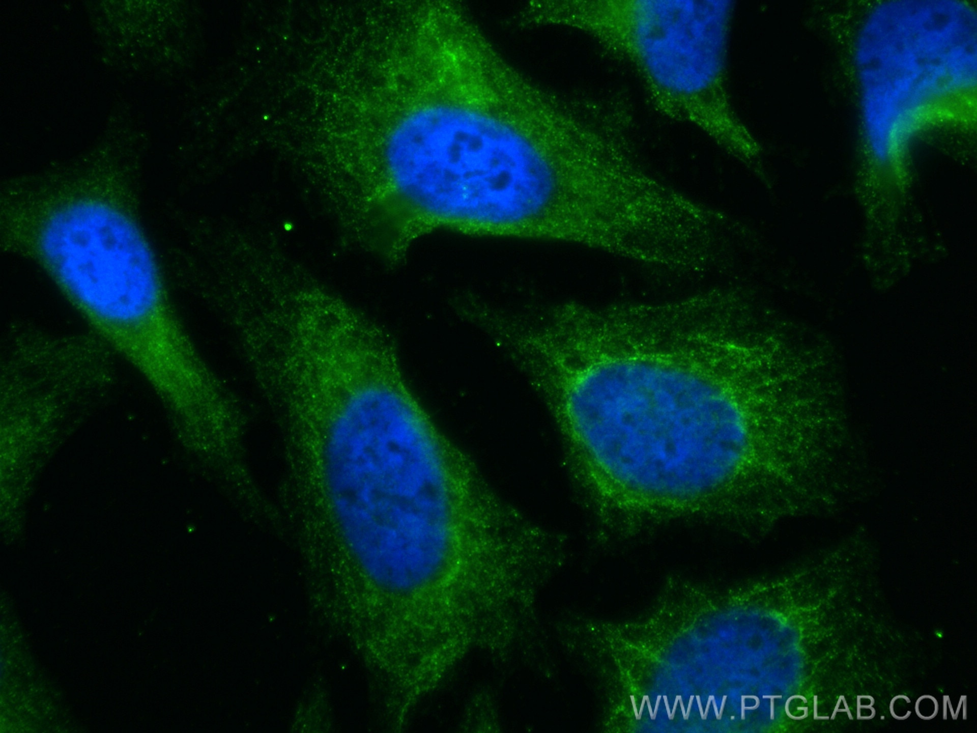 Immunofluorescence (IF) / fluorescent staining of HeLa cells using GEF-H1 Polyclonal antibody (24472-1-AP)