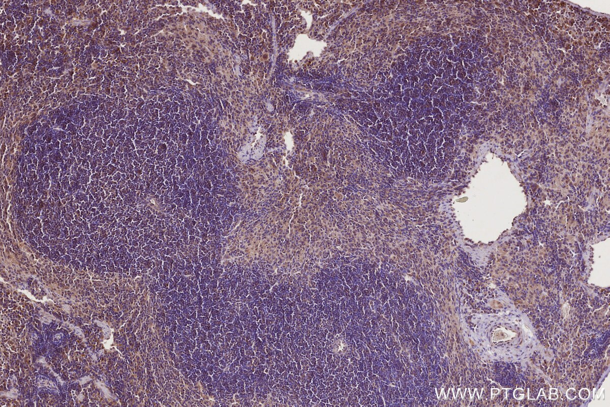 Immunohistochemistry (IHC) staining of mouse spleen tissue using GEF-H1 Polyclonal antibody (24472-1-AP)