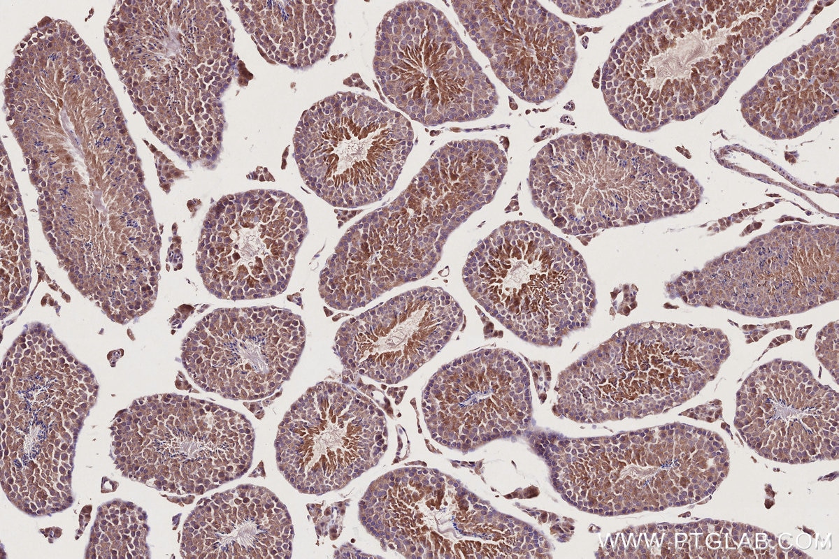 Immunohistochemistry (IHC) staining of mouse testis tissue using GEF-H1 Polyclonal antibody (24472-1-AP)