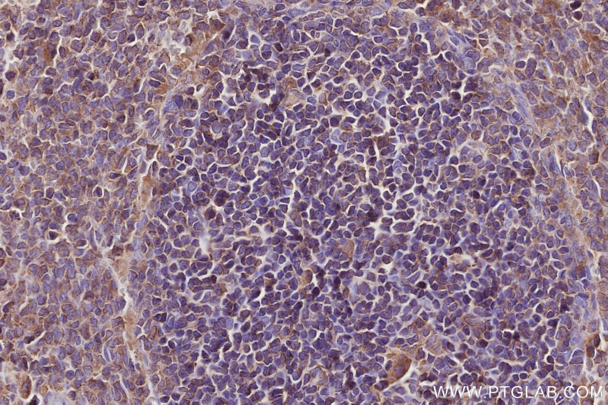 IHC staining of rat spleen using 24472-1-AP Immunohistochemistry (IHC) staining of rat spleen tissue using GEF-H1 Polyclonal antibody (24472-1-AP)