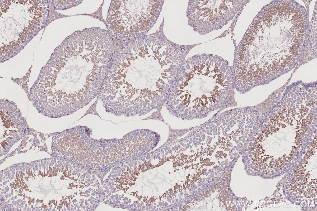 IHC staining of rat testis using 24472-1-AP Immunohistochemistry (IHC) staining of rat testis tissue using GEF-H1 Polyclonal antibody (24472-1-AP)