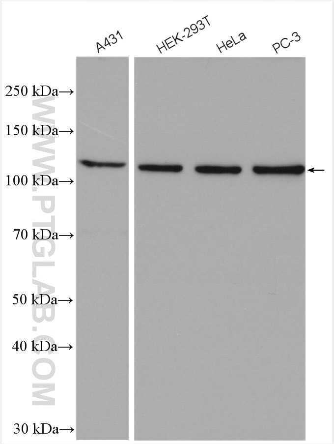 Western Blot (WB) analysis of various lysates using GEF-H1 Polyclonal antibody (24472-1-AP)
