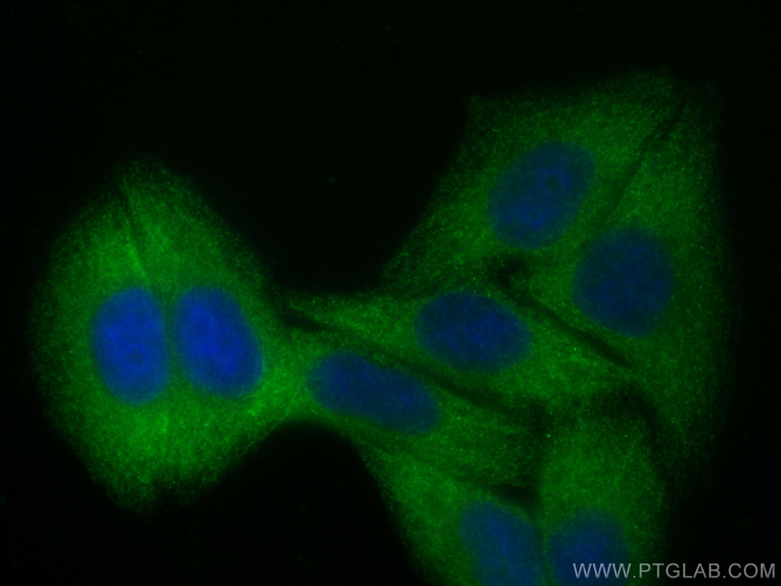 Immunofluorescence (IF) / fluorescent staining of HepG2 cells using CoraLite® Plus 488-conjugated GEF-H1 Polyclonal an (CL488-24472)